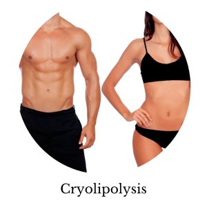 cryolipolysis
