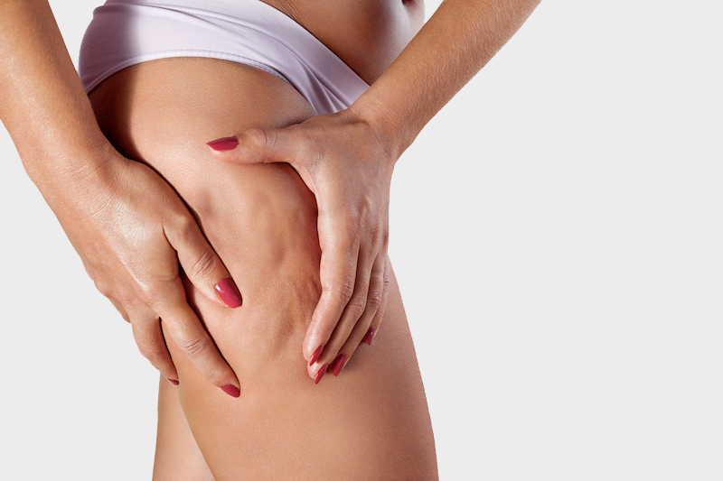 How to Fight Cellulite in Aesthetic Medicine