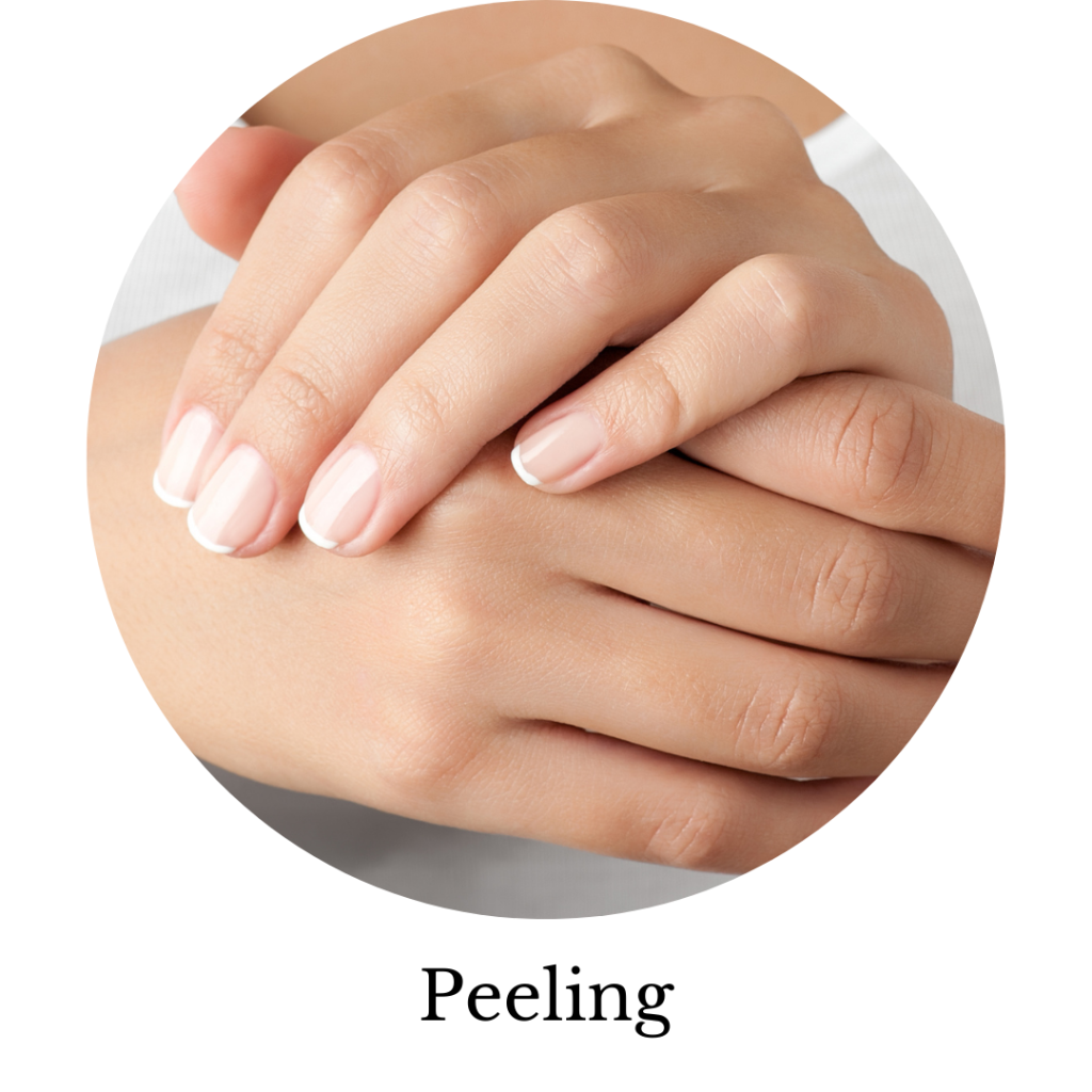 Peeling mains