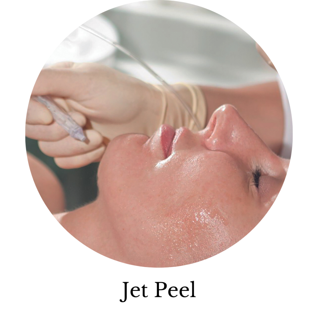 Jet Peel