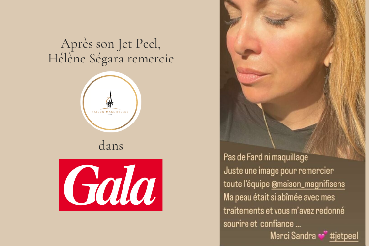 Hélène Ségara dans Gala pour le Jet Peel de Maison Magnifisens