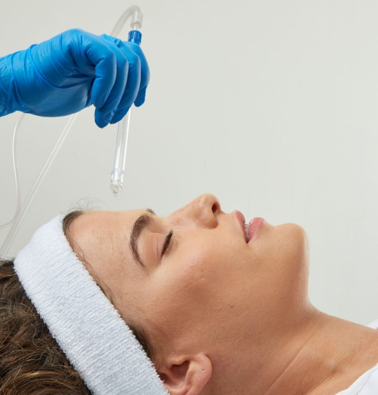 Jet Peel skin care